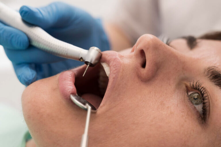 Iperplasia gengivale